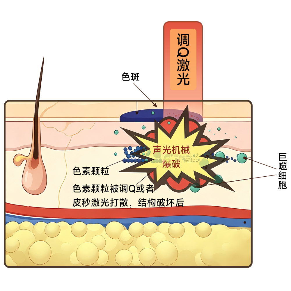 声压机械爆破.jpg